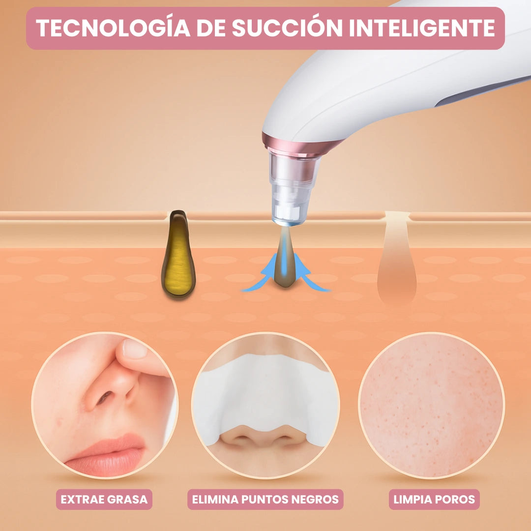 Extractor Eléctrico de Espinillas y Limpieza Facial Profesional + 4 Extractores Manuales