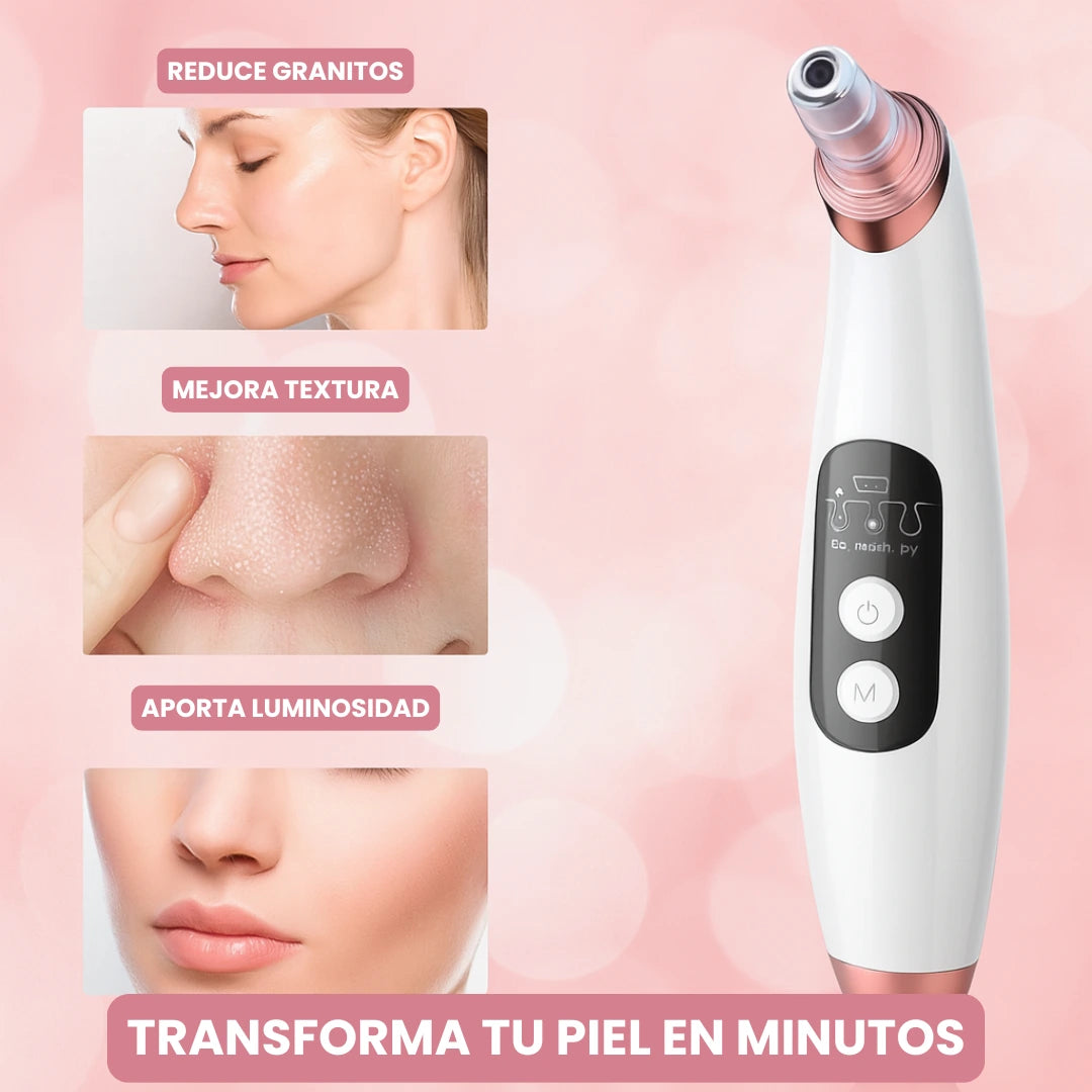 Extractor Eléctrico de Espinillas y Limpieza Facial Profesional + 4 Extractores Manuales