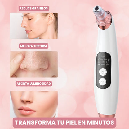 Extractor Eléctrico de Espinillas y Limpieza Facial Profesional + 4 Extractores Manuales